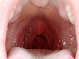 300人のおくち 第1集　サンプル画像04